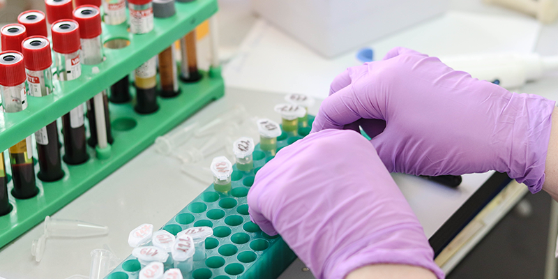 十年長青！博大博聚JSY型全自動細(xì)胞計數(shù)儀：憑什么成科研人心中的細(xì)胞計數(shù) “經(jīng)典款”？